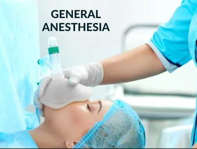 geneeal_anesthesia